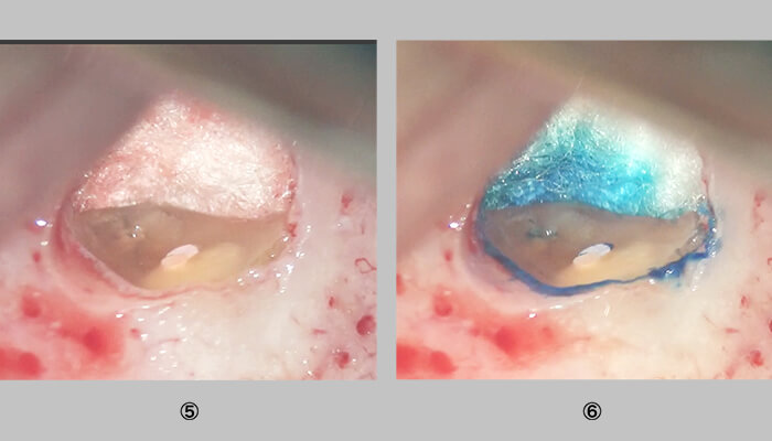 歯根切断面を染色した直後の写真